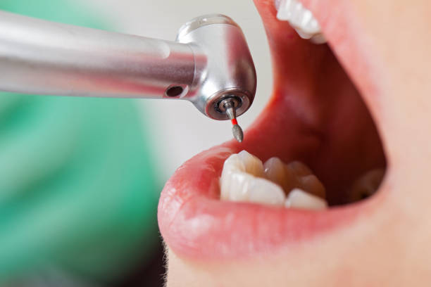 Best Weekend Emergency Dentist in Anderson, MO